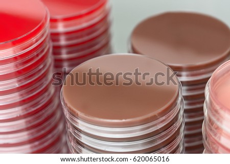Red and brown petri dishes stacks in microbiology lab. Focus on stacks.