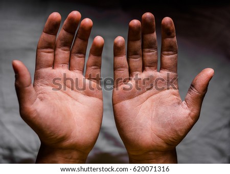 begging dirty palms blurred background