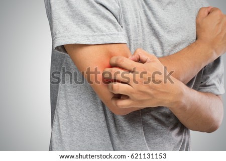 People scratch the itch with hand, Elbow, itching, Healthcare And Medicine, Men with skin problem concept