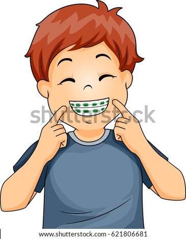 Illustration of a Little Boy Flashing a Wide Smile and Proudly Showing His Dental Braces
