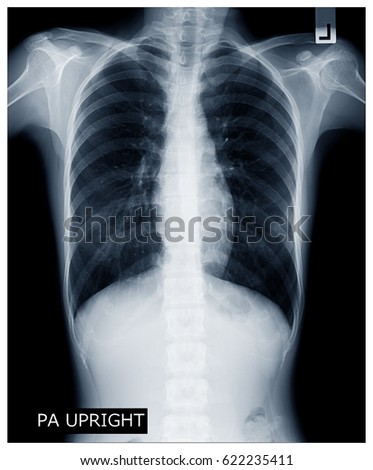 X-ray image of human body chest, very good quality