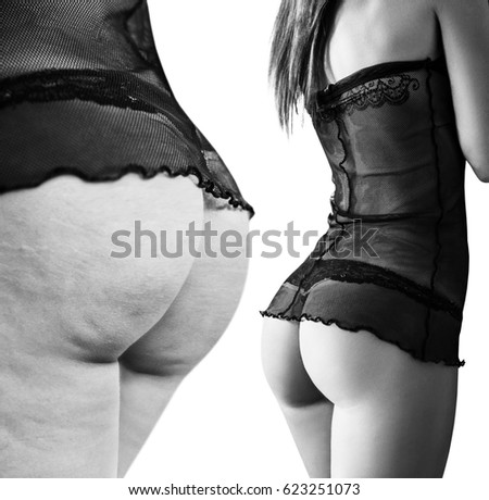 Female buttocks before and after cellulite.