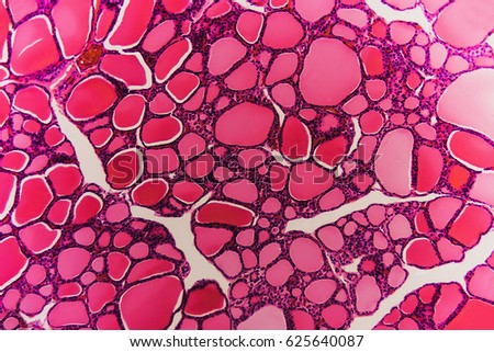 Cell thyroid gland dog- abstract science. Histological preparation- dissection of animal tissue into thin layers with microtome. Educational material for the study and treatment. Royalty-Free Stock Photo #625640087