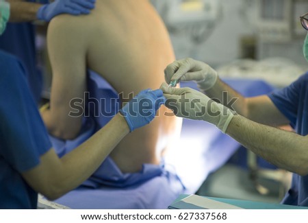 The doctor prepares the injection epidural