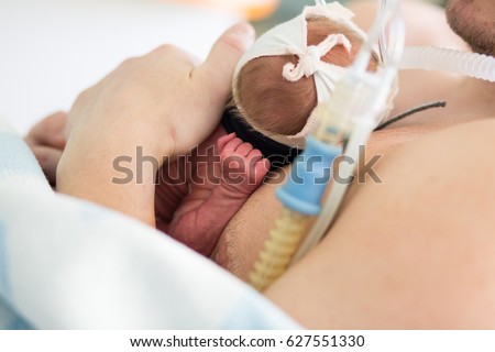 father holding a premature baby with an oxygen mask
in Kangaroo method 