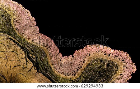 Cross section of a normal stomach showing pyloric mucosa. The photo shows deep gastric pits which reach half of mucosa depth. Colors are enhanced for better visualisation