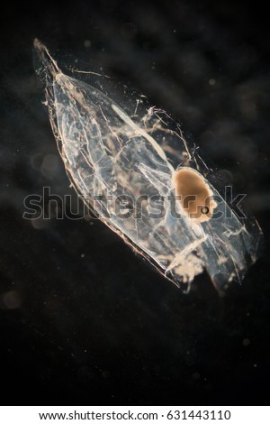 Ctenophora (zooplankton) under the microscope.