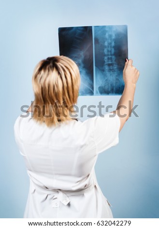 Female doctor looking at an x-ray.