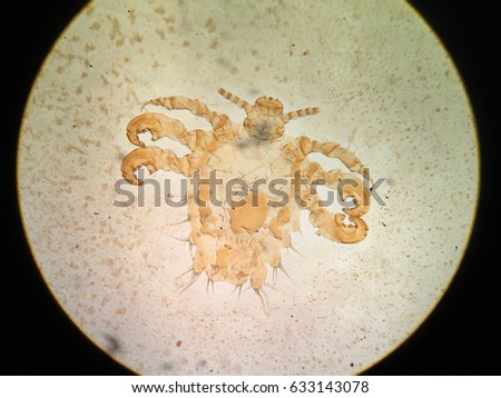 Pubic louse In light microscope