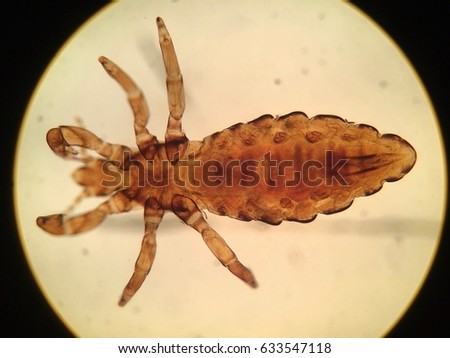 Head louse in light microscope