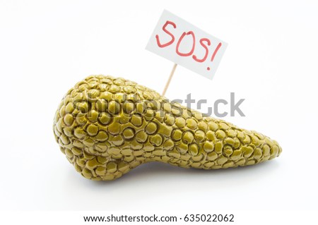 Anatomical 3D model of pancreas gland lies on white background with placard inscripted SOS, asking doctor or patient for medical help, care or treatment. Concept of symptom of pancreatic diseases
