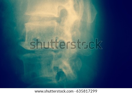 Close up spinal cord bone  x-ray medical science background