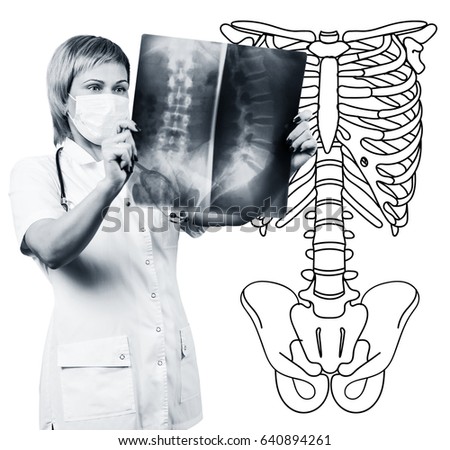 Female doctor looking at an x-ray.