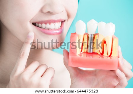 woman take tooth implant false tooth on green background Royalty-Free Stock Photo #644475328