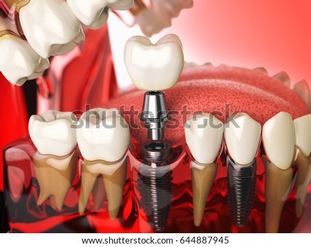 Human Teeth 3d Model Free Download