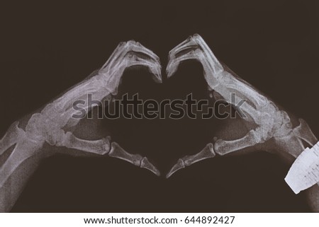 X-ray image of hands making heart symbols.