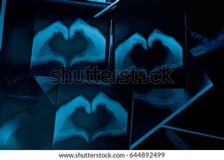 X-ray image of hands making heart symbols.