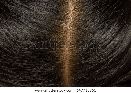 Scalp and dark hair
