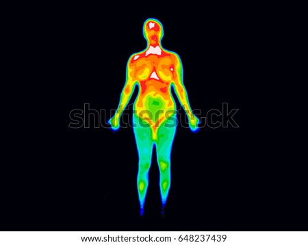 Thermographic image of the front of the whole body of a woman with photo showing different temperatures in range of colors from blue showing cold to red showing hot, can indicate joint inflammation.  Royalty-Free Stock Photo #648237439