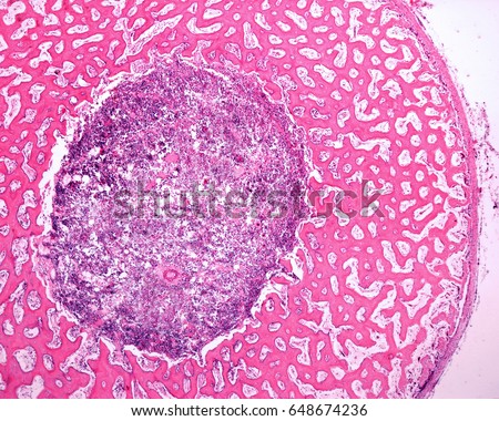 Cross-section of the diaphysis of an immature bone. The periosteum surroundsthe cortical of immature or primary woven bone tissue. The intensely stained material of the center is the bone marrow.  Royalty-Free Stock Photo #648674236