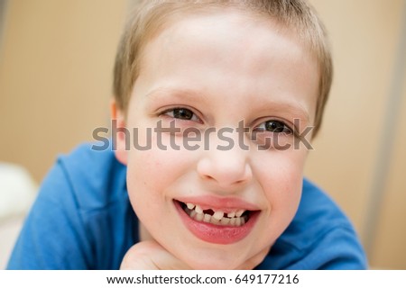The mouth of a boy without a tooth