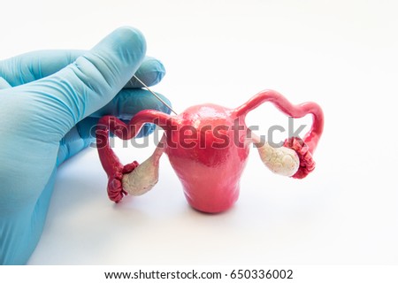 
Concept photo of gynecological surgical procedure of biopsy female reproductive organs and tissues - uterine, endometrium or ovaries. Doctor in glove conducting biopsy operation punctures uterus