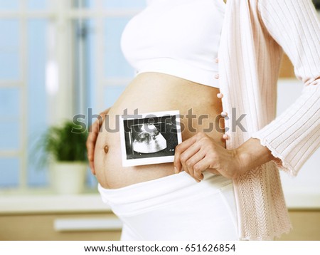 pregnant woman holding ultrasound next to stomach
