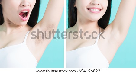 beauty woman take picture with under armpit problem before and after