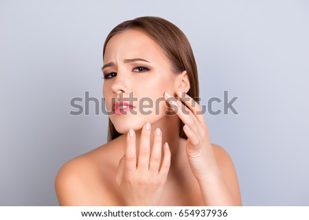 Perfection is a hard work. Acne, pimple, clear and clean, oily, dry  skin concept. Cose up cropped photo of worried young lady touching her face gently Royalty-Free Stock Photo #654937936
