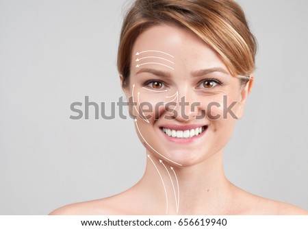 Concept of skin rejuvenation. Face lift anti-aging treatment - woman with massage lines showing facial lifting effect on skin  Royalty-Free Stock Photo #656619940