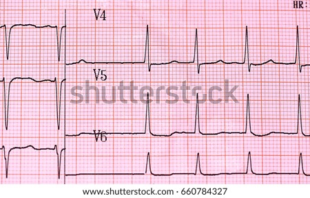 Cardiogram on paper