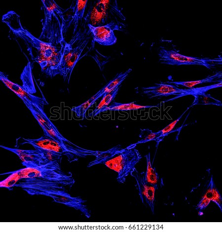 Immunofluorescence confocal imaging of melanoma cancer cells Royalty-Free Stock Photo #661229134