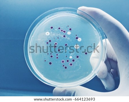 Agar plate full ofmicro bacterias and microorganisms Royalty-Free Stock Photo #664123693