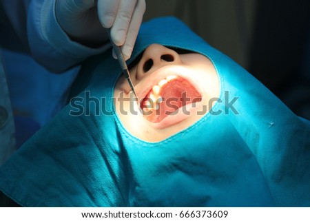 Dental treatment by filling the decay.And make ultraviolet rays to solidify the material.