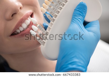 Odontologist selecting dental crown for beaming female