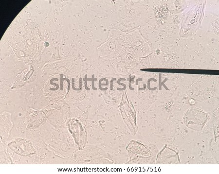 red particles in urine