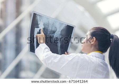 Smart woman doctor check hip bone cancer film x-ray image from machine. Analyze a progress of disease after complete chemotherapy,surgery and take medicine therapy. Healthy concept. Royalty-Free Stock Photo #671641264