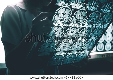 alzheimer's disease on MRI Royalty-Free Stock Photo #677115007