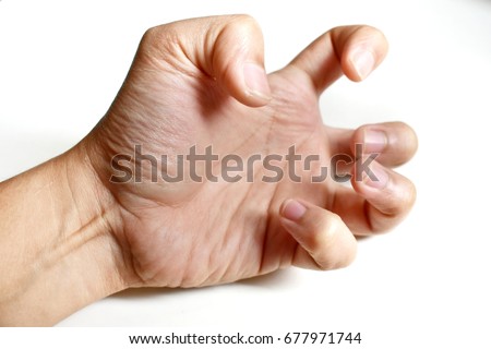 isolated tense hand cause of Seizures or palalysis