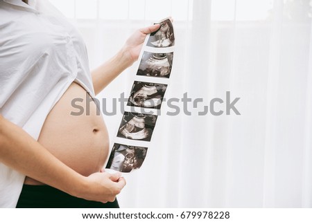 Happy Family , Pregnant Woman Holding Ultrasound Image Result from Doctor 