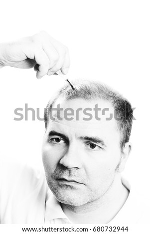 Middle-aged man concerned by hair loss bald baldness alopecia black and white