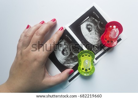 Twin pregnancy. Two soothers,an ultrasound picture of two babies and a mother's hand.