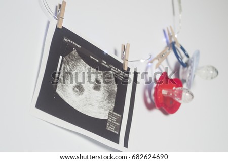 Twin pregnancy. Two soothers and an ultrasound picture of two babies.