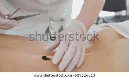 Doctor in clinic puts on leech on skin of woman Royalty-Free Stock Photo #683626513