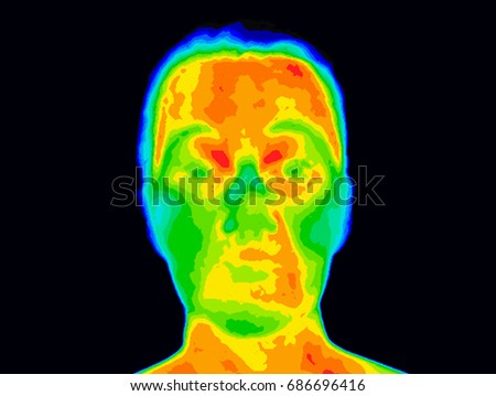 Thermographic photo of a human face showing different temperatures in a range of colors from blue cold to red hot. Red and orange around mouth could be a sign of periodontal disease with inflammation. Royalty-Free Stock Photo #686696416