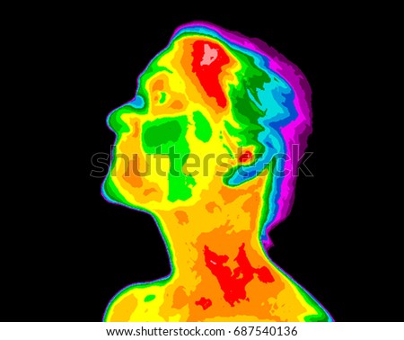 Thermographic image of human face and neck showing different temperatures, from blue cold to red hot.Red in neck possible cartoid inflammation, Cerebrovascular Accident (CVA) (medical term for stroke) Royalty-Free Stock Photo #687540136