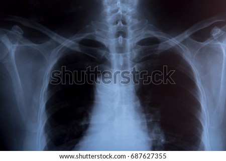 x-ray drawing of a human chest 