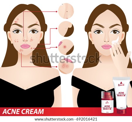 types of acne , skin problems vector illustration