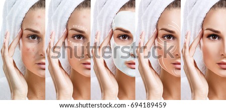 Beautiful woman step by step improves her skin condition. Skin care concept. Royalty-Free Stock Photo #694189459