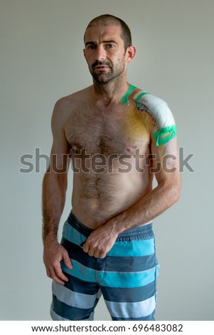 Man with bandages on shoulder recovering from surgery in surf shorts with a white background